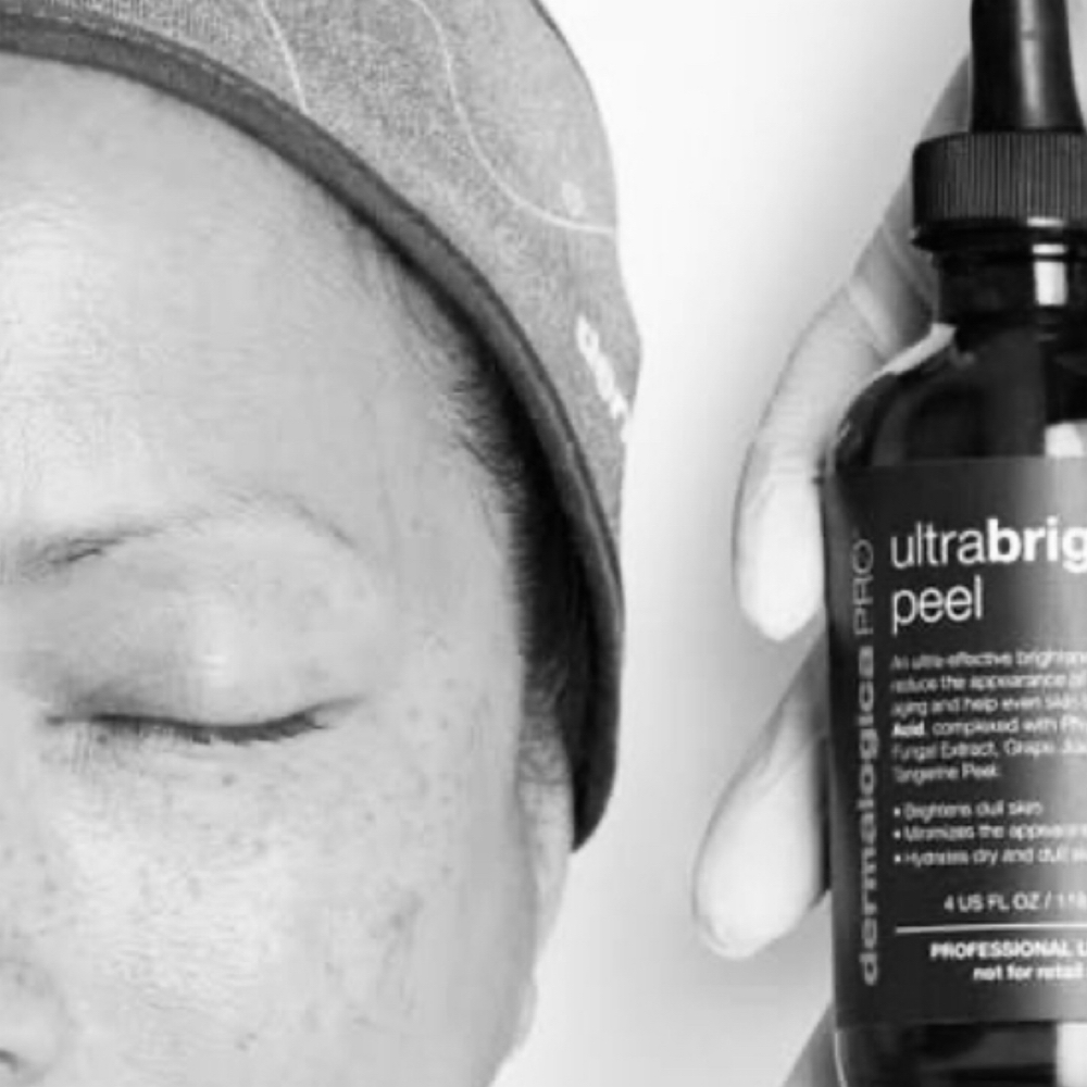 UltraBright Peel at SkinByIzabella in Toledo, OH