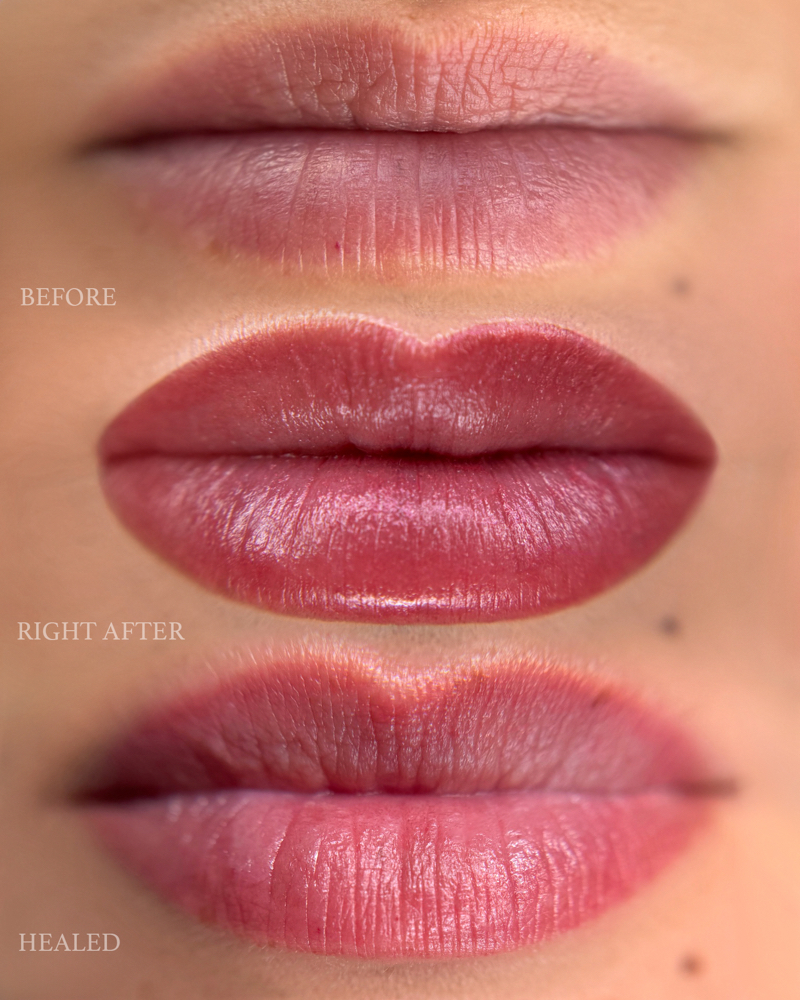 Touch Up Lips