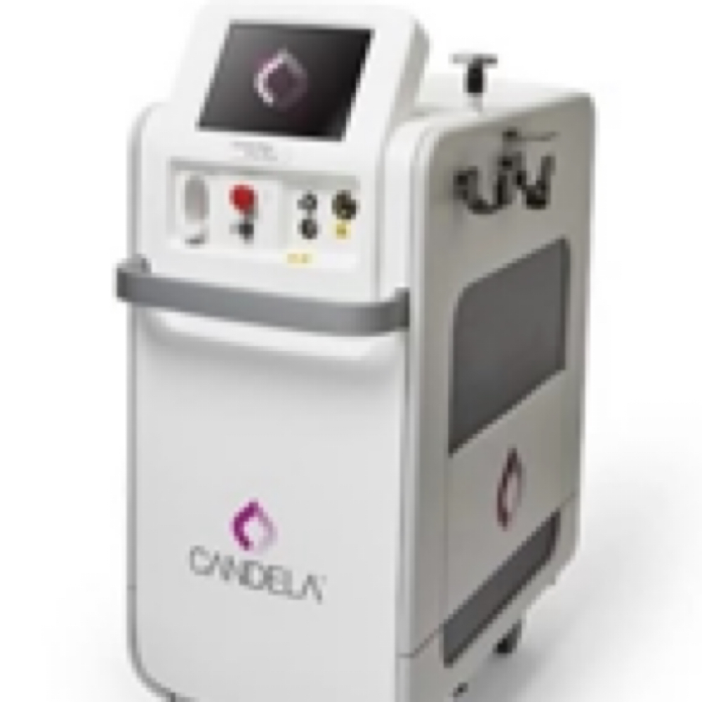 Laser Freckle Treatment