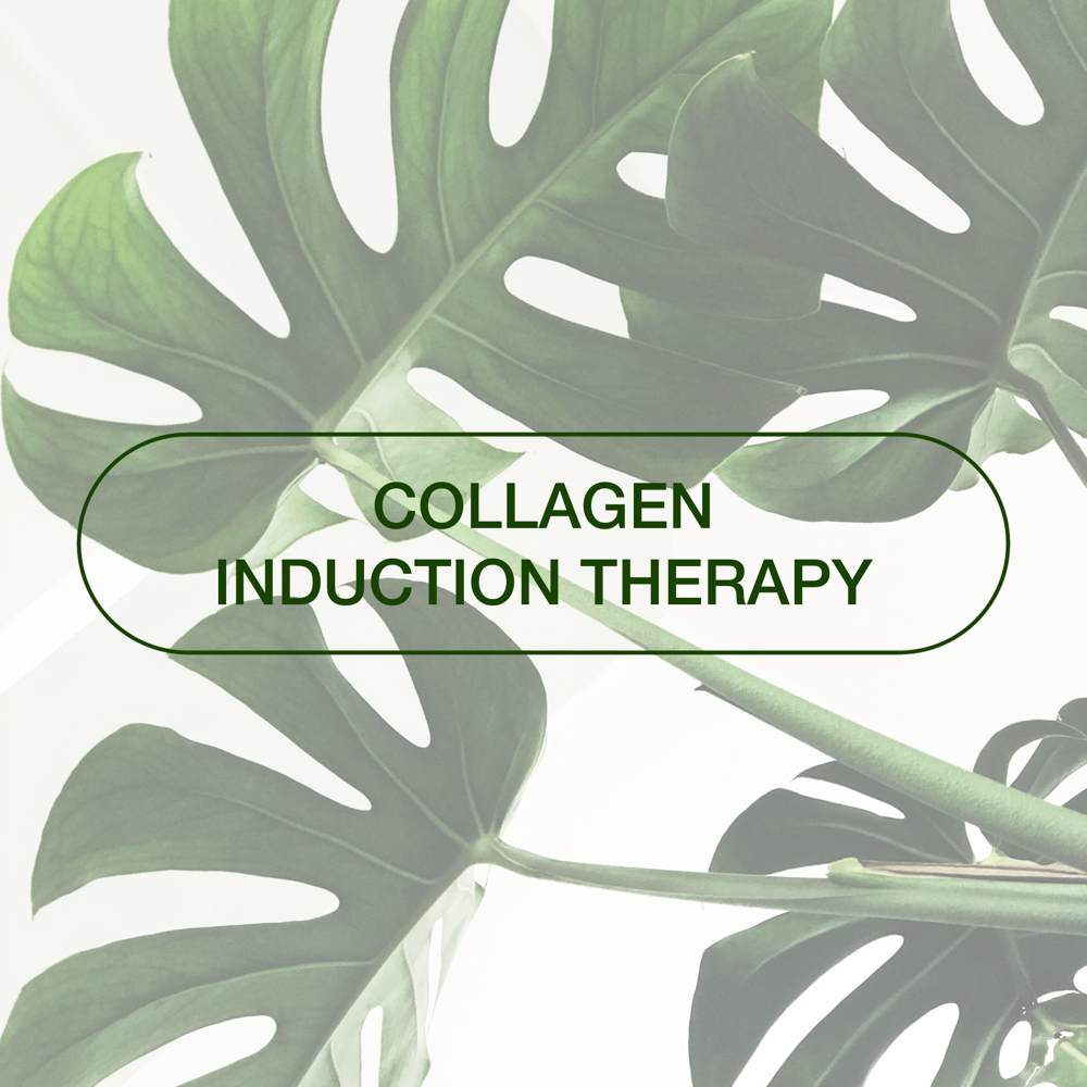 Collagen Induction Therapy