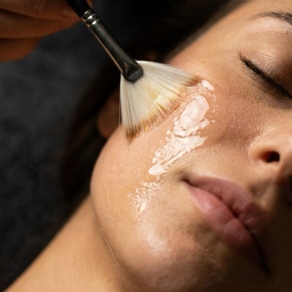 Customized Chemical Peel at BeyondTheFace in Charlotte, NC