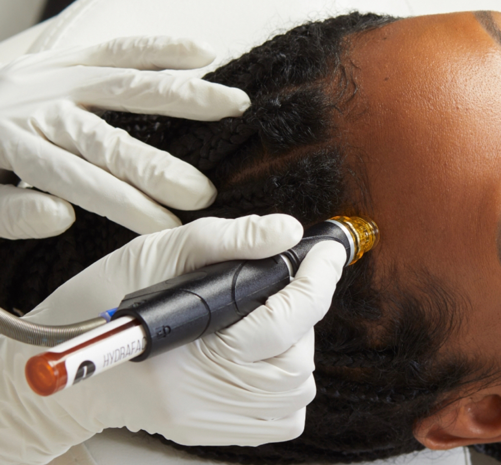 SCALP HYDRO TREATMENT