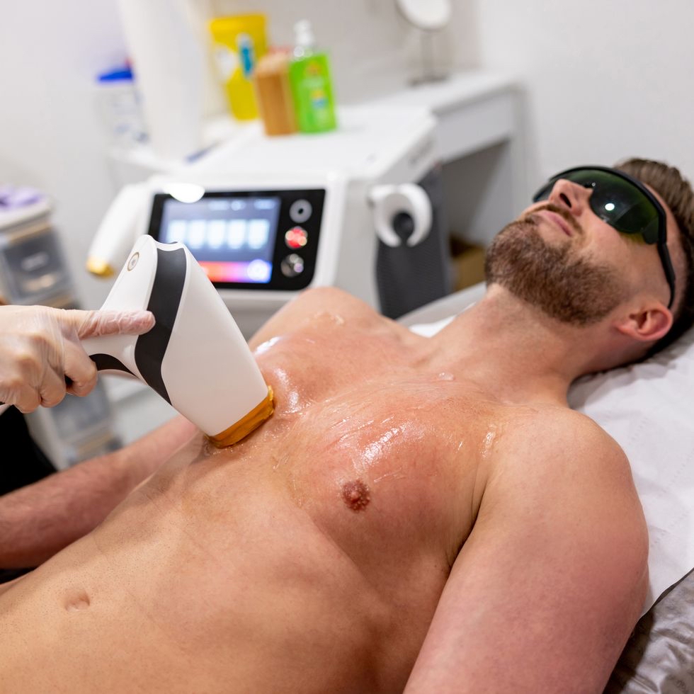 Chest Laser Hair Removal