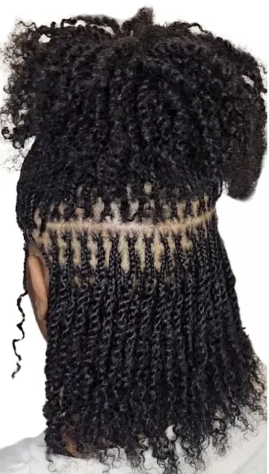 MICRO LOCS RETIGHTENING