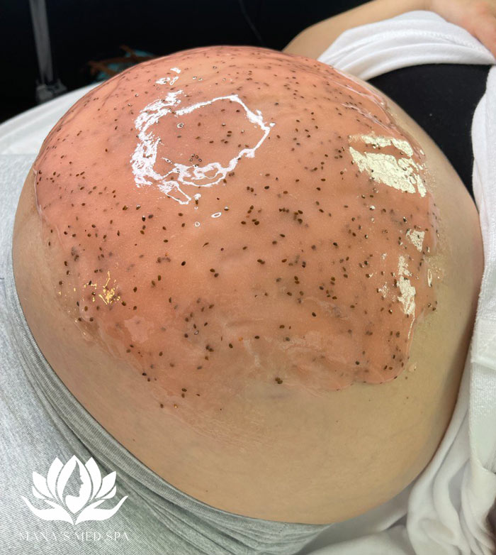 Baby Bump Facial