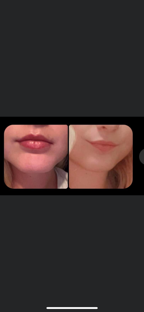 Return customers with numbing cream