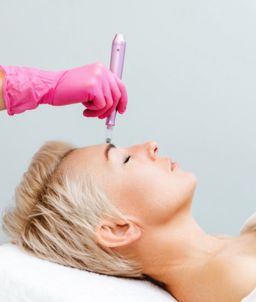 Collagen Induction Therapy