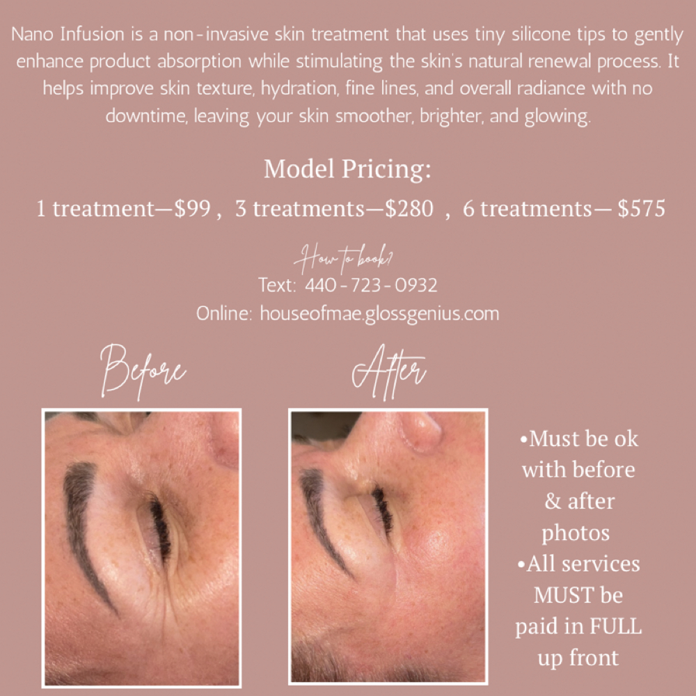 Nano Infusion Model 6 Treatments at House of Mae Madilyn Anney Esthetics in Amherst, OH