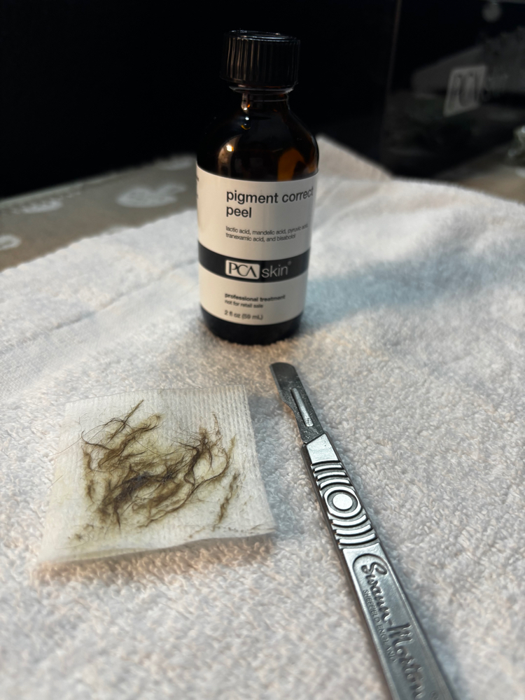 Sun-Kissed Chemical Peel🌿