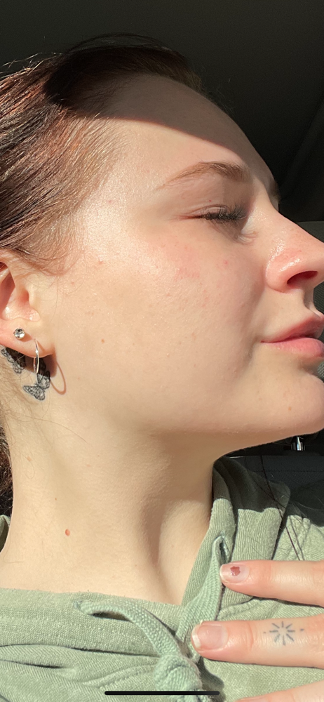 Specialized Facial