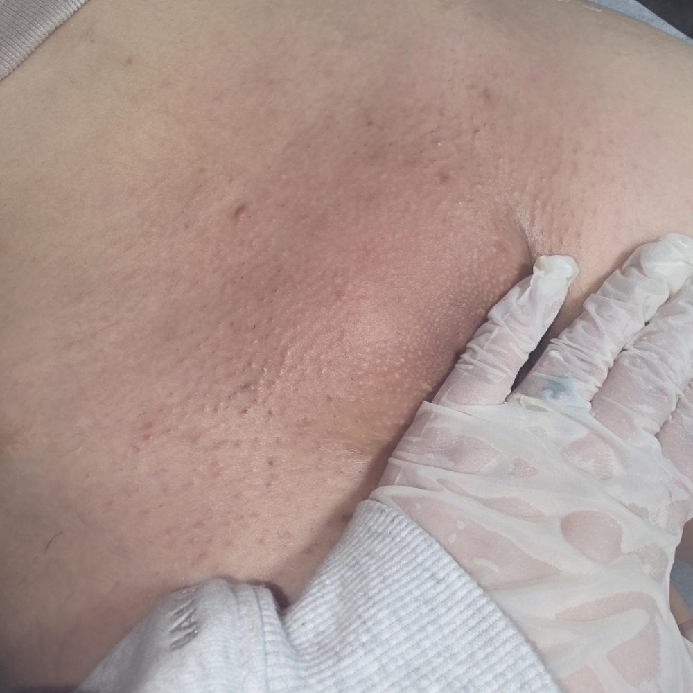Brazilian Wax at Lizza's Beauty Bar in Milpitas, CA