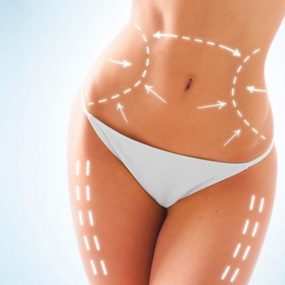 BODY Sculpt - EASTER SALES at SKINROOM by Luz Yailyn in Toa baja, PR