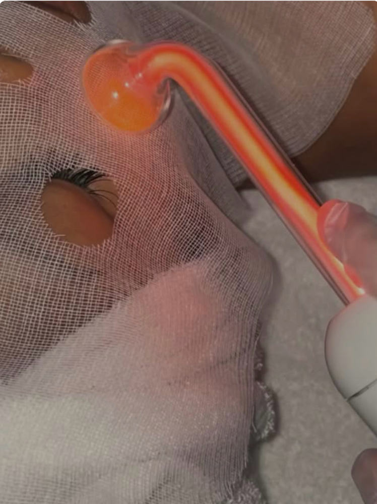 High Frequency at KayLuxAesthetics in Fuquay-Varina, NC