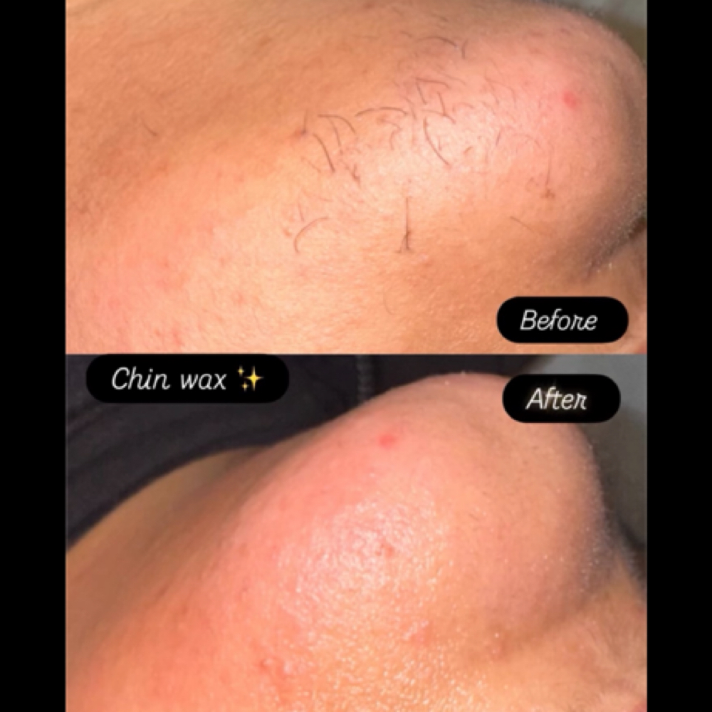 Chin Wax at Queensmade Esthetics in Wilmington, NC