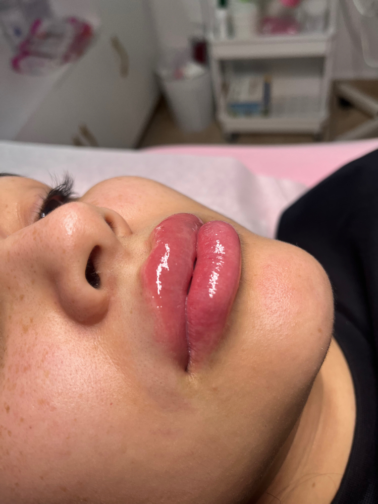 Hidratacion De Labios