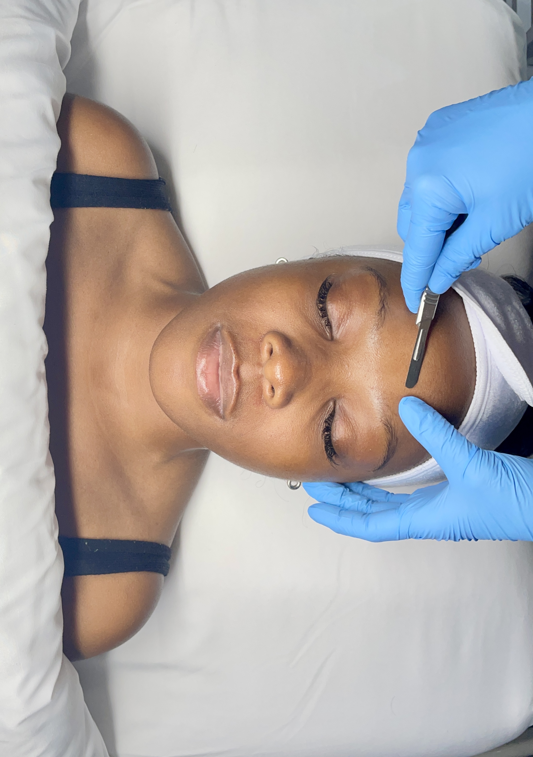 Dermaplane Add-on To Microneedling