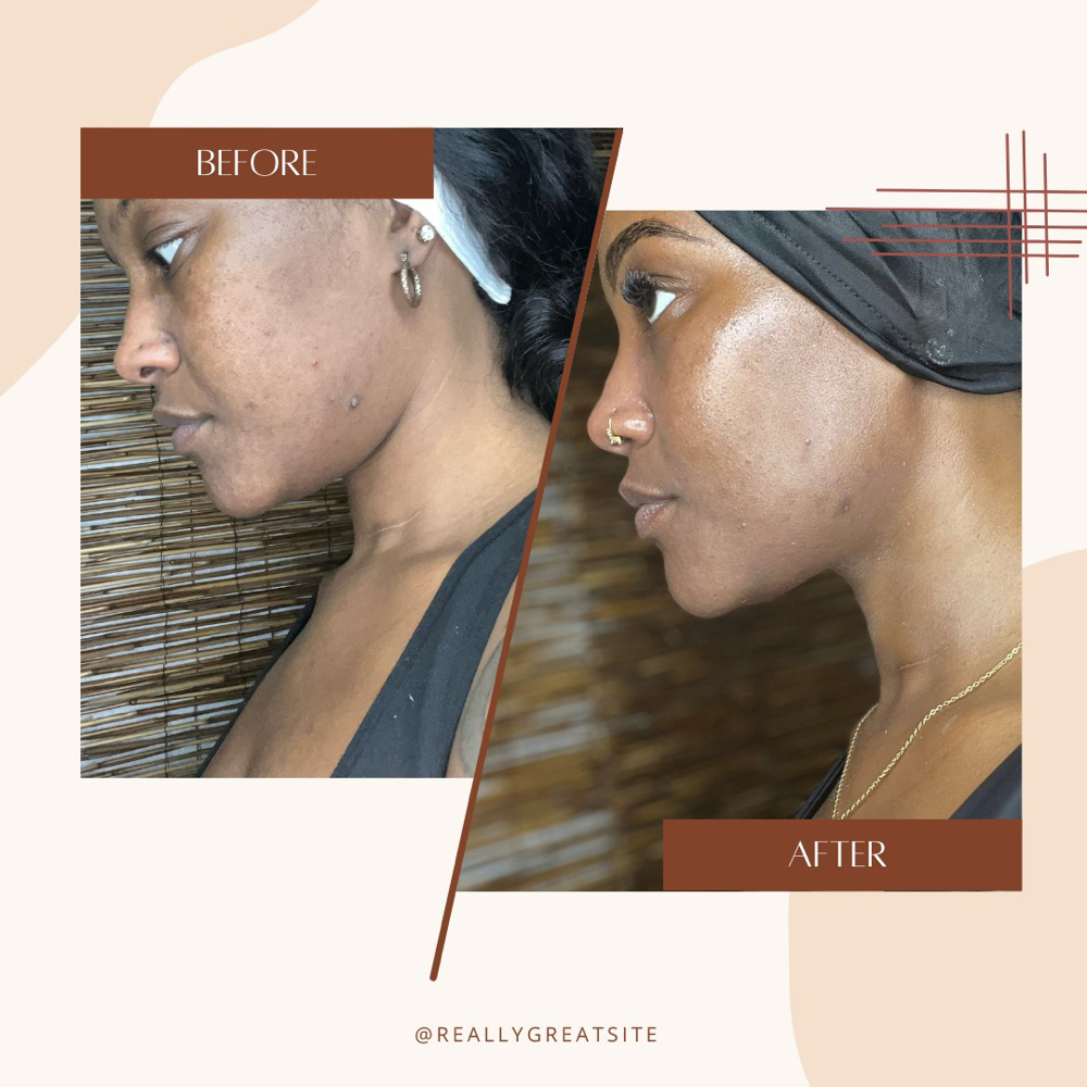 Skin Reset + Regimen Starter Facial at VANITY GROVE CO in JACKSONVILLE, FL