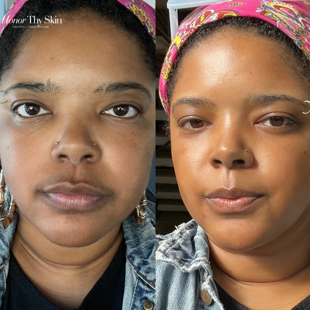 Honor Thyself Facial ~ New Client at Honor Thy Skin in Charlotte, NC