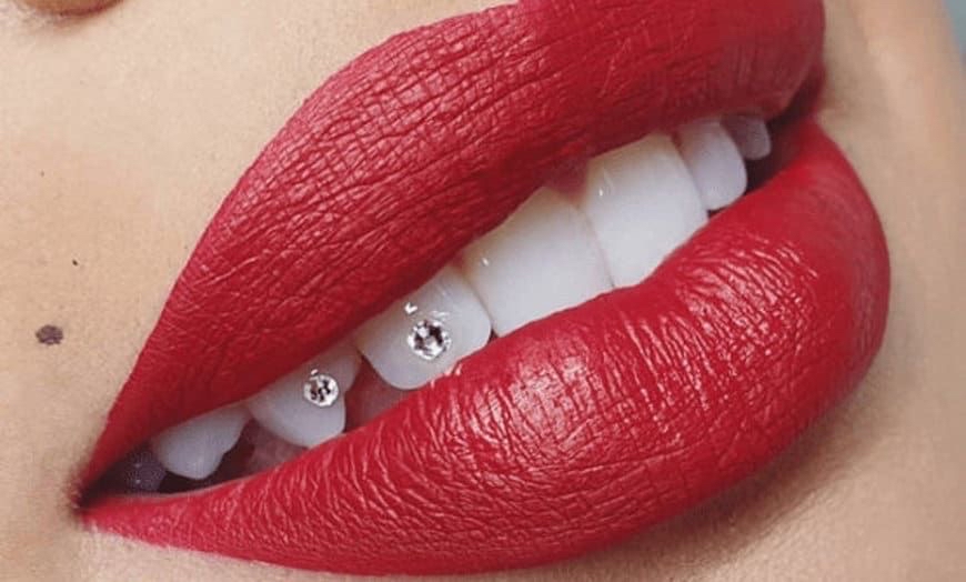 Tooth Gems💎
