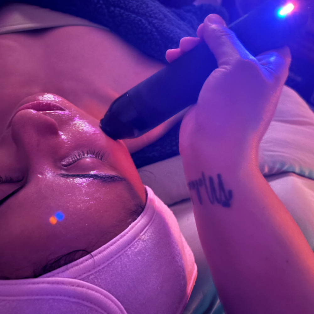 Glo₂ RF Pro Glow Enhancement at The Holistic Glow in Gainesville, FL