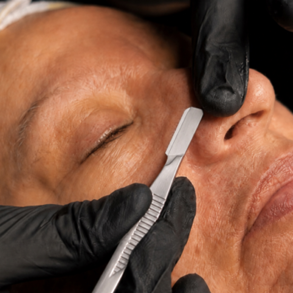 CYNN’S Dermaplane Facial at CYNNSBEAUTY in Tustin, CA