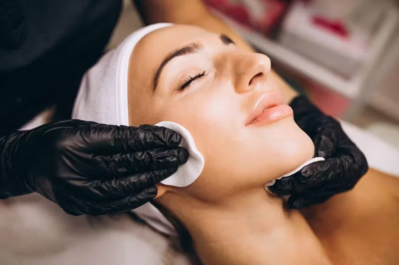 Chemical Peel Level 1