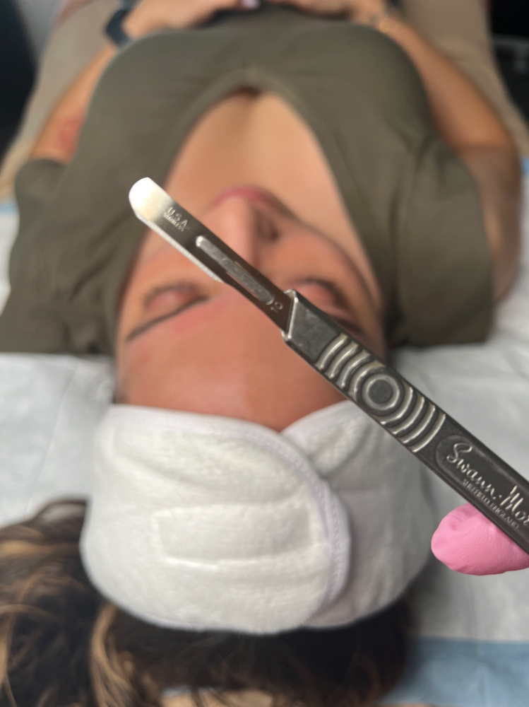 Add On: Dermaplane