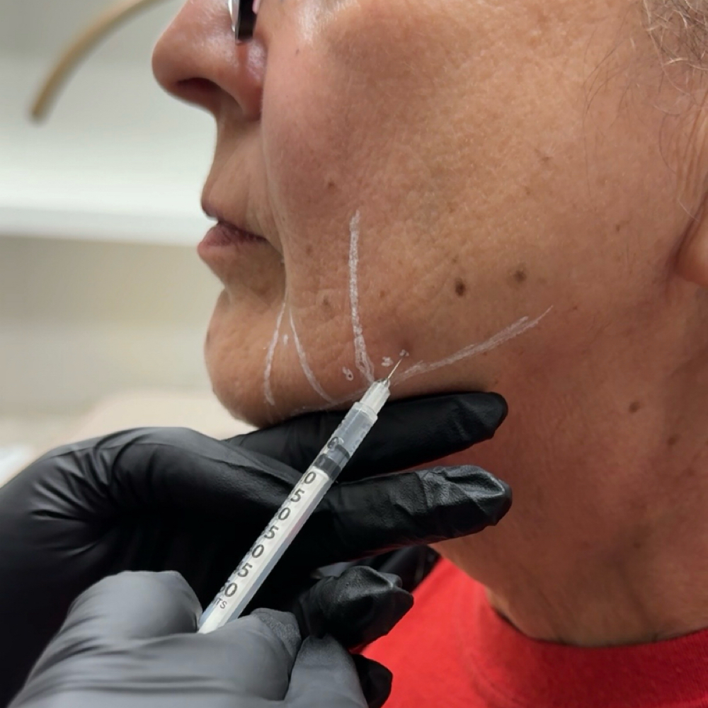 DAO’s & Jowls at AJ Rey Injects in Wolfforth, TX