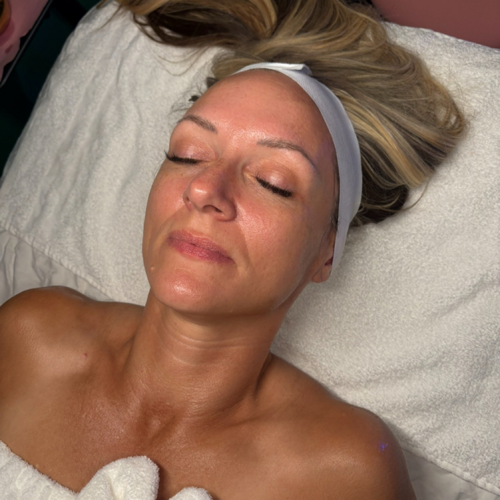 Cytopeel BASIC Facial at GlowByDawsEsthetics in Abilene, TX
