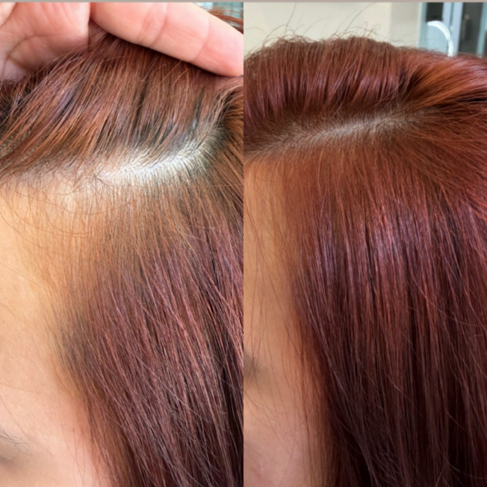 Calecim Treatment (6 Week) at LTORRESxHAIR ✨ in Richardson, TX