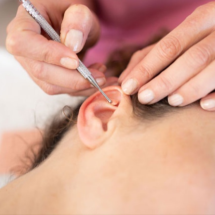 Auricular Therapy Session 60-Minute at The Home Practice