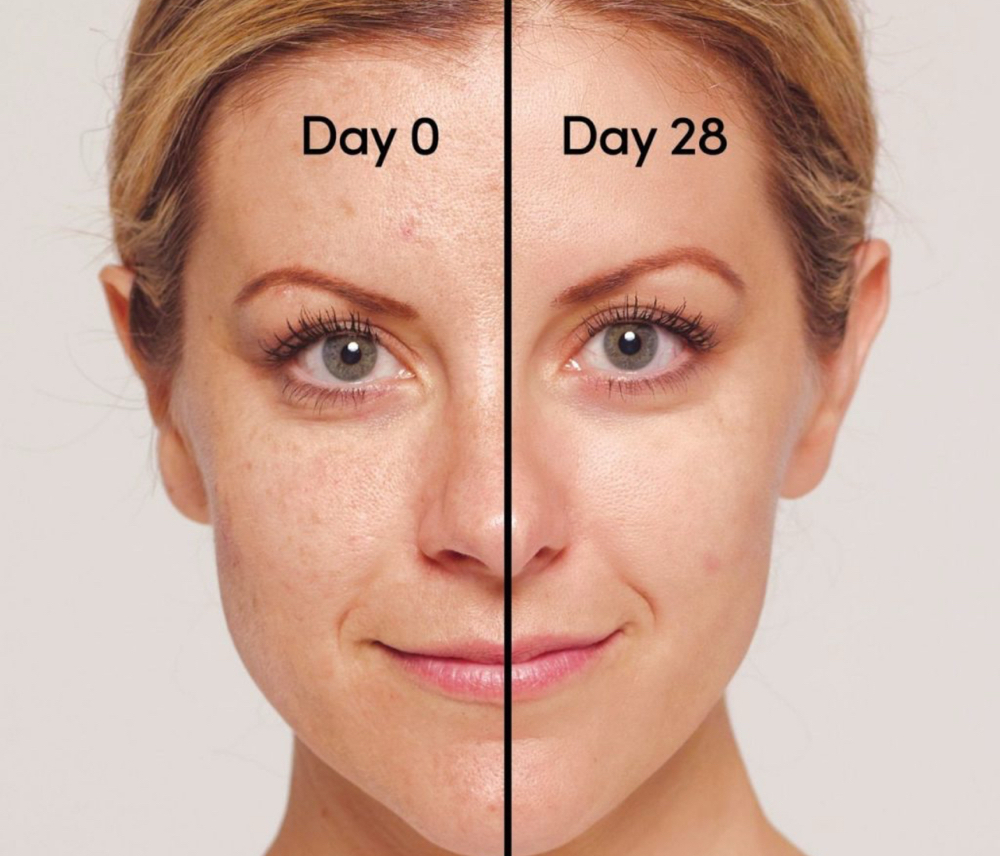 Retinol & Glow