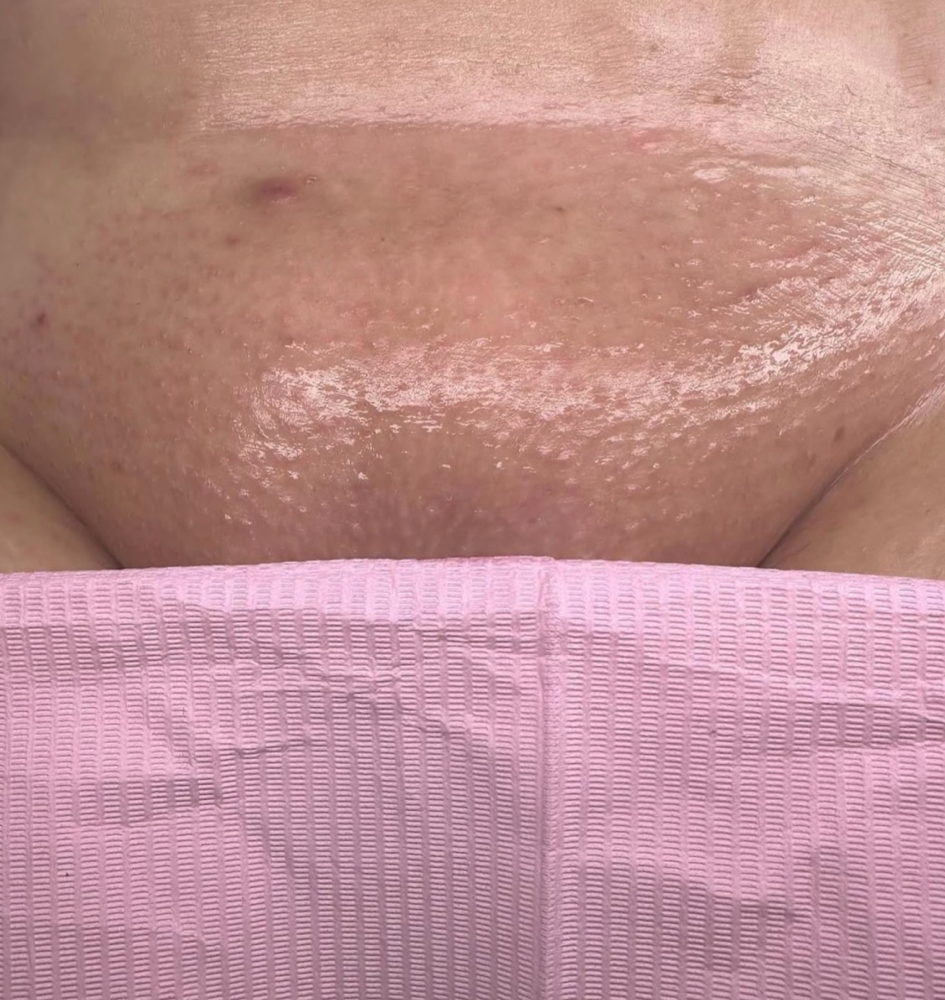 Brazilian Wax