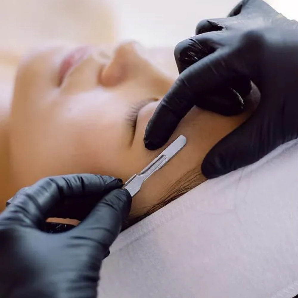 Dermaplaning Treatment at Aesthetics by Abby in Alliance, OH