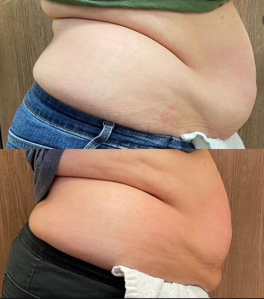 Body Sculpting (1 Month Sub)