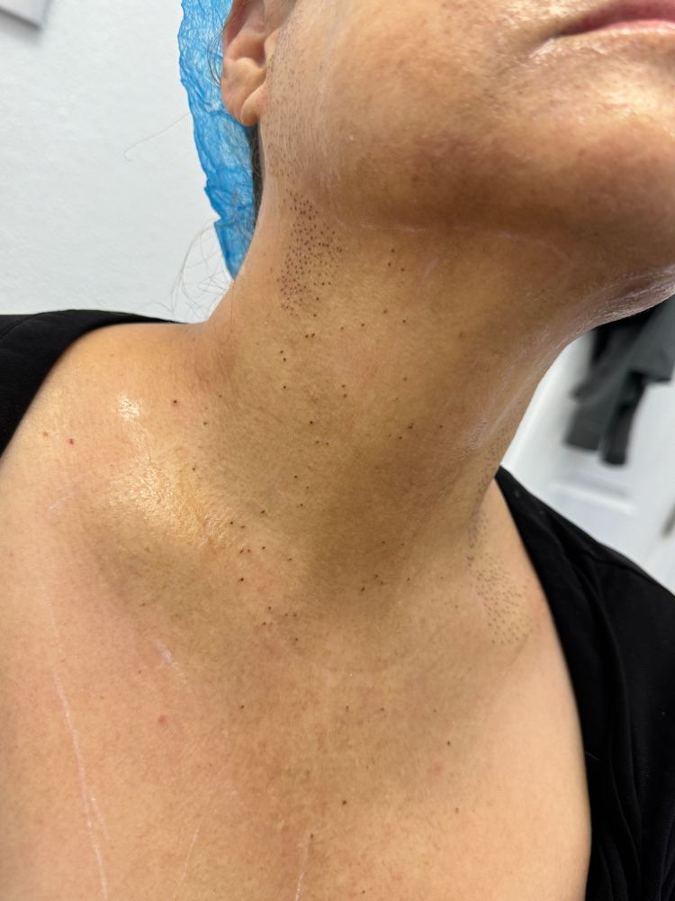 Neck Rejuvwnation