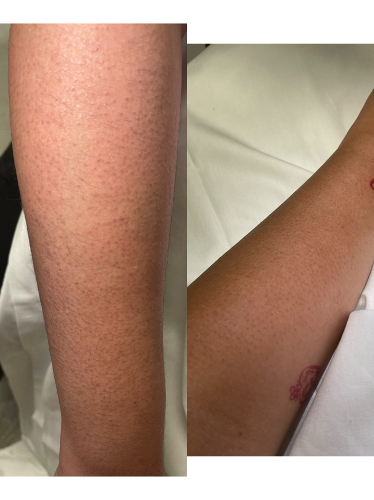 Arm Wax (half)