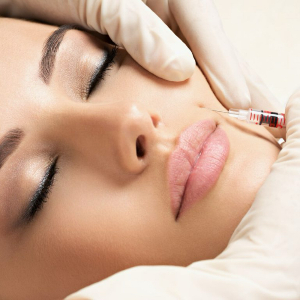 Nasolabial Fold Treatment at Refyned Aesthetics & Wellness in Greenville, TX