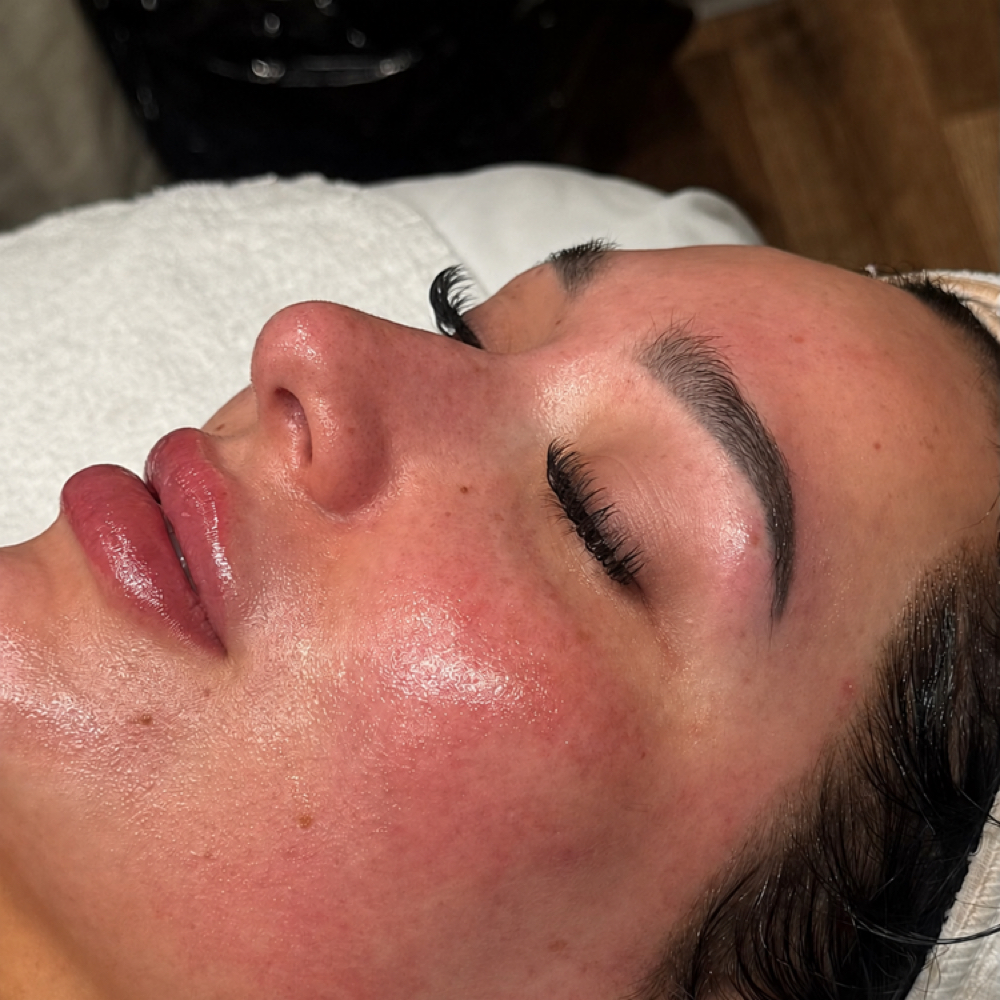 Microdermabrasion Skin Refinement at SKIN BY HAYLEE in Rochester, MN