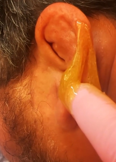 Ears (Male)