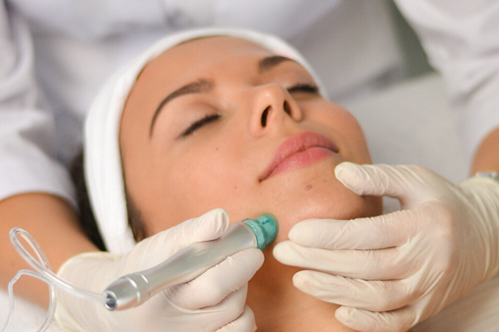 Hydrodermabrasion facial