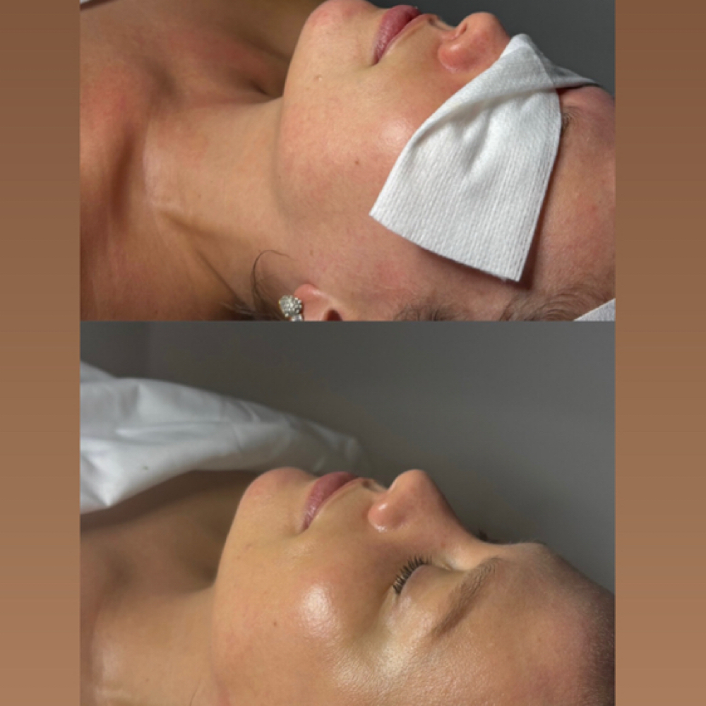 Advanced Corrective Facial | 90 Min at Emmanuel Aesthetique in Brooklyn, NY