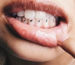 Tooth Gems