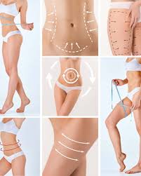 Fat Dissolve Injections