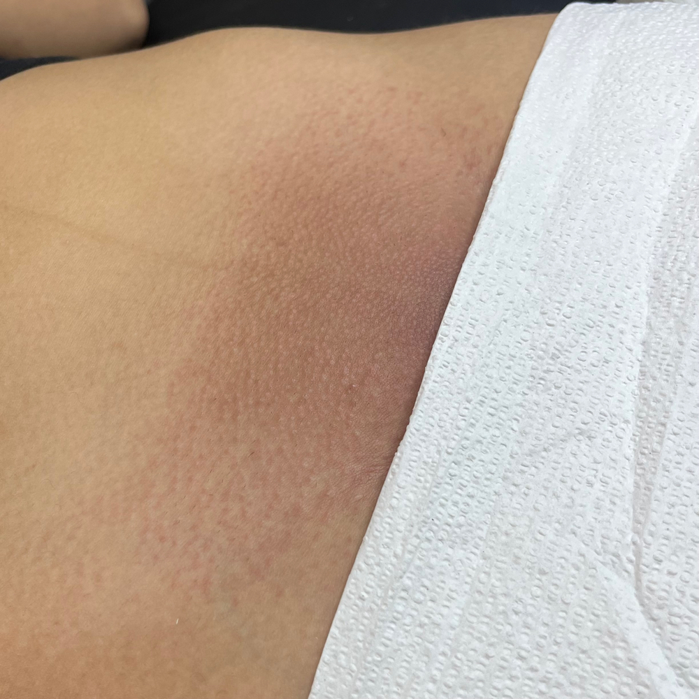 Womens Brazilian - CURRENT CLIENT