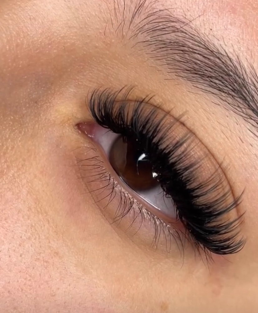 Soft Volume at Kyonce' Aesthetics in Buffalo, NY