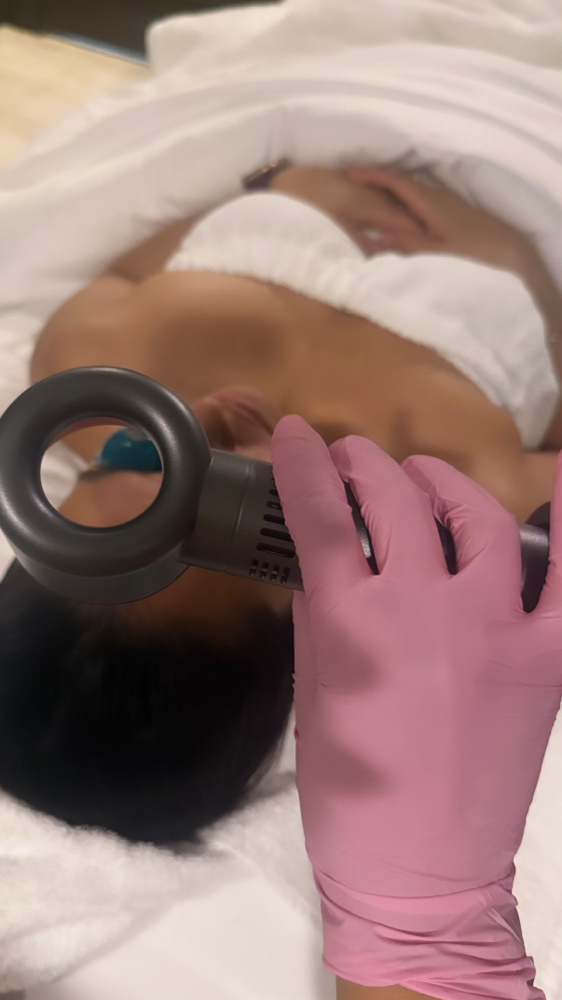 Signature Chemical Peel