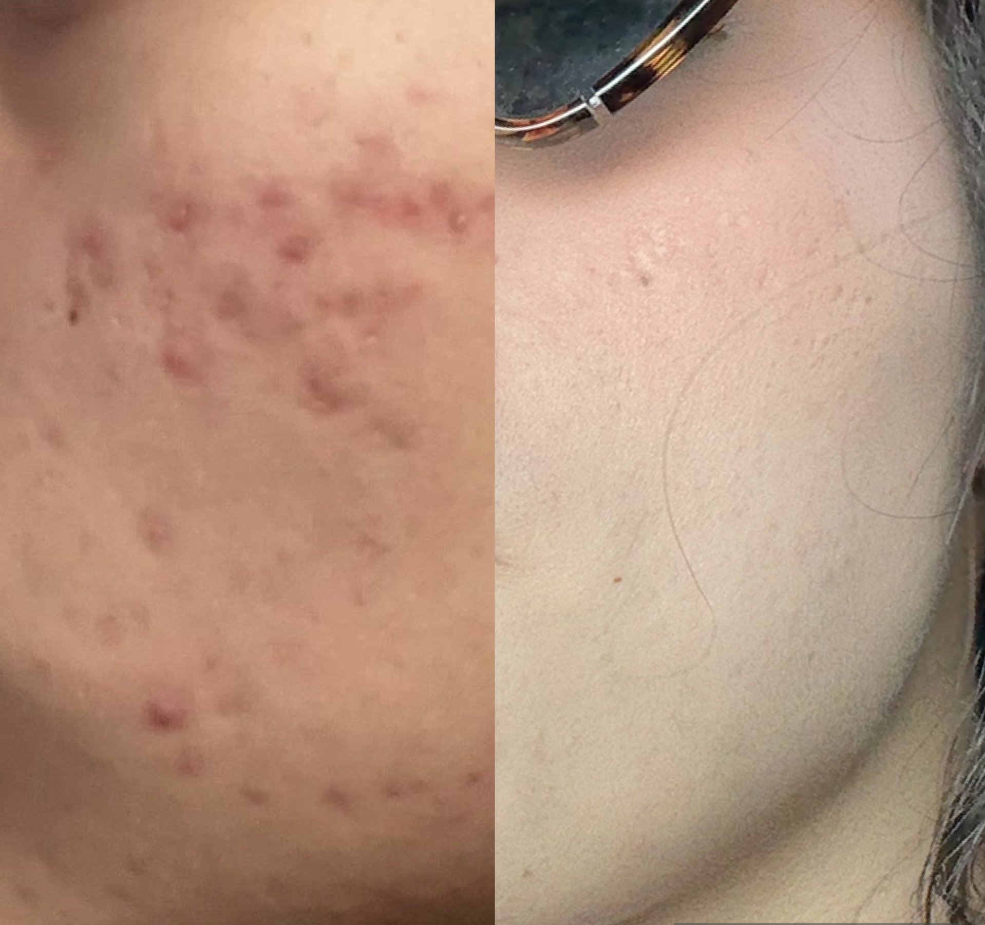 The Clarity Corrective Series at Skin Savvy Solutions | Corrective Skin Care | Facials in Hallandale Beach, FL