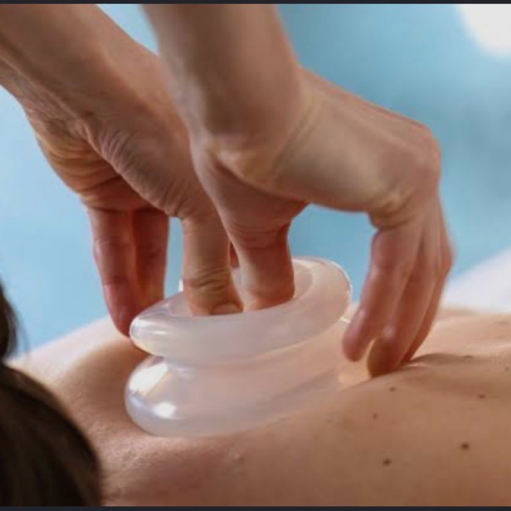 Cupping Therapy at Therapeutic Bliss AZ LLC in Surprise, AZ