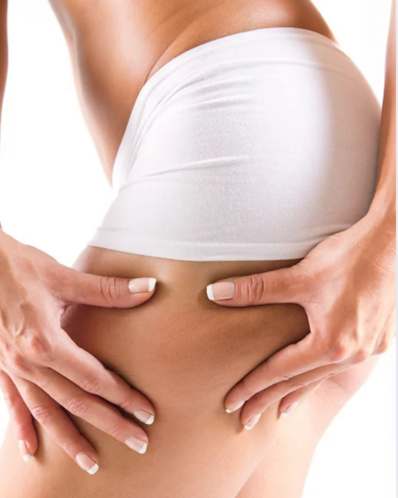 HIFU Muslos- One Session